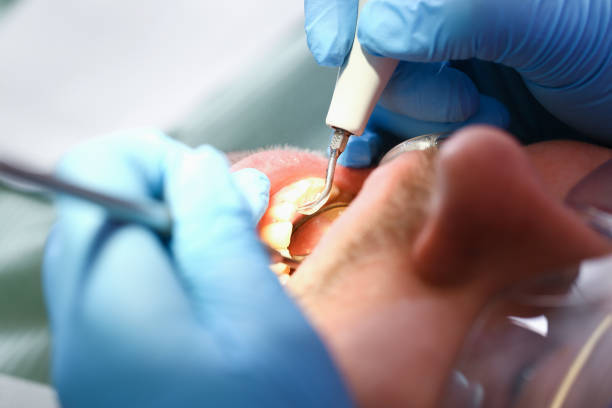 Best Walk-In Emergency Dental Services in Center Hill, FL