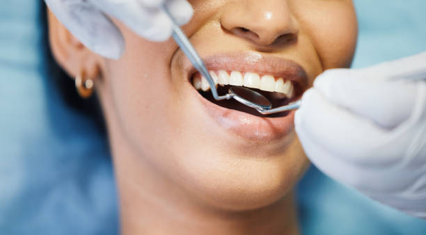Best Walk-In Emergency Dental Services in Center Hill, FL