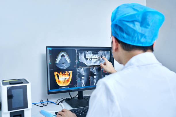 Best Knocked-Out Tooth (Avulsed Tooth) Treatment in Center Hill, FL
